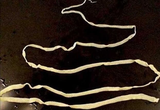 tapeworm from the human body