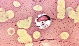The simplest parasites