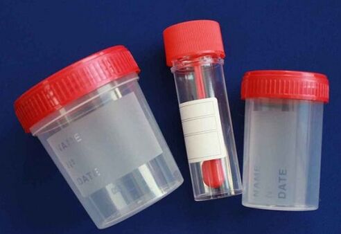 jars for testing for parasites