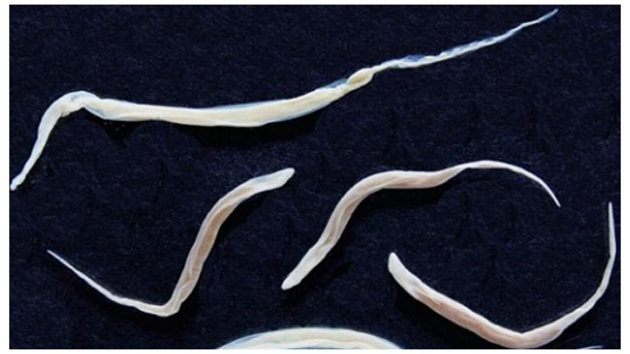 Pinworms are common parasites belonging to the group of helminths.